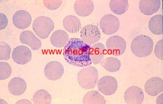 vivax_female_gametocyte.jpg (10769 ֽ)
