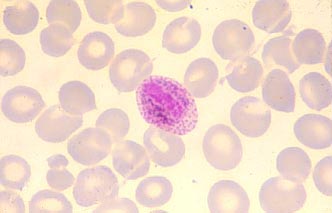 vivax_male_gametocyte.jpg (10415 ֽ)